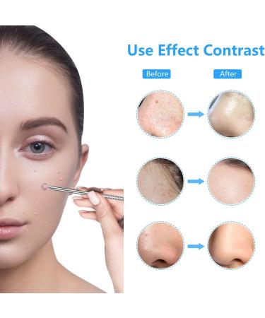 Acne Remover Tools Nose Acne Remover Stainless Made Blackhead Remover Tool Acne Blemish Needle Pimple Spot Extractor Pin-Extractor Acne Tool Pimple Spot Popper Silver - Buy Online on GoSupps.com