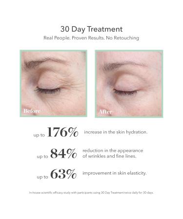 BIOEFFECT 30 Day Anti-Aging Treatment | Hydrating EGF Serum for Face & Neck | Plant-Based Wrinkle-Fighting Formula with Hyaluronic Acid - Buy Online on GoSupps.com