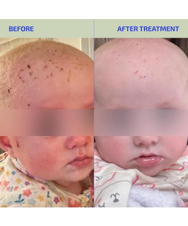 Codex Labs Infant & Toddler Skin Barrier Support - Unflavored L-Histidine Supplement with Vitamins & Minerals - 30 Servings Tested for Sensitive & Eczema-Prone Skin - Made in USA - Buy Online on GoSupps.com