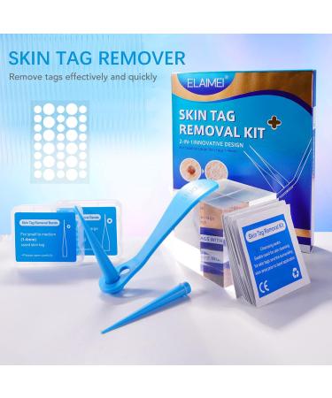 2-IN-1 Micro Skin Tag Tool Kit Quick and Painless Solution for Medium to Large Skin Tags (2mm-7mm) Complete Skin Tag Tool Kit for Fast Results - Buy Online on GoSupps.com