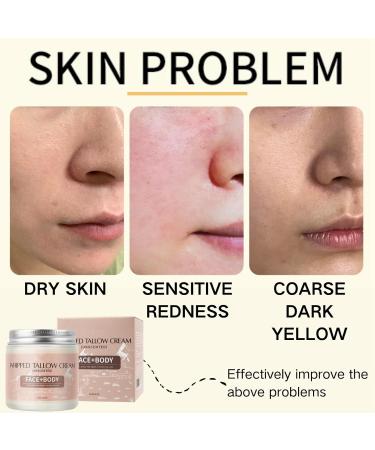 Body Lotion Women - Body Lotion with Tallow Olive Squalane Niacinamide - Moisturiser for Dry Skin - Body Skin Care - Hydrating Nourishing Repairing Body Moisturiser - Unscented - Buy Online on GoSupps.com