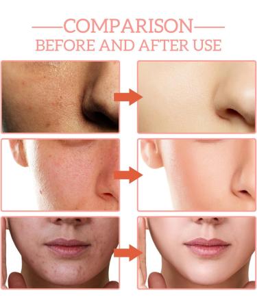 15 x 30 ml Aloe Vera Serum with Hyaluronic Acid for Face Brightening & Hydrating Facial Serum for Fine Lines AntiAging Facial Serum Suitable for All Skin Types - Buy Online on GoSupps.com