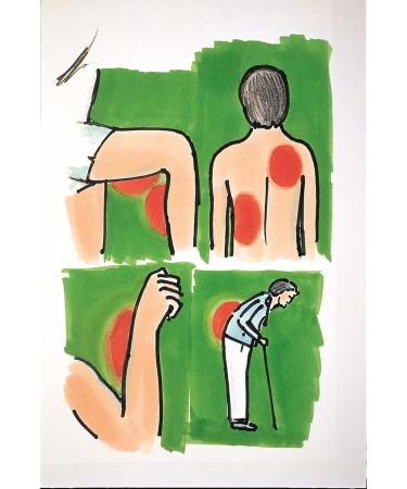 Medosan 2 SPARSET Incense & Massage Balm | Boswellia Ayurveda for Joint Pain Relief | Premium Quality Ingredients - Buy Online on GoSupps.com