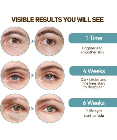 Caffeine Eye Serum Under Eye Cream for Dark Circles and Puffy Eyes with Hyaluronic Acid Niacinamide Moisturizing Anti-Wrinkle Skincare Serum for Men and Women Eye Treatment 30ml (eye serum) - Buy Online on GoSupps.com