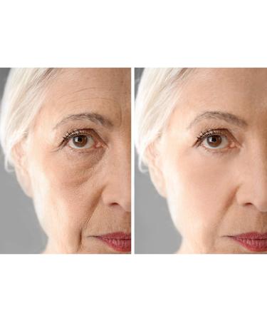 DERMAWORKS Instant Face Lift Serum for Dark Circles, Puffy Eyes & Wrinkles - Buy Online on GoSupps.com