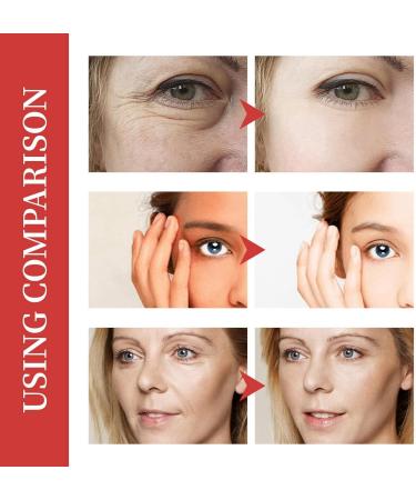 10% Lactic Acid Serum + Hyaluronic Acid Serum Vitamin C Serum Lactic Acid 10% Serum Anti Aging Serum Lactic Acid Pore Minimizer Serum Hyaluronic Acid Moisturiser Hydrating Serum for All Skin Types - Buy Online on GoSupps.com