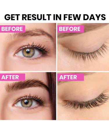 Advanced Eyelash & Brow Growth Serum - 6 month Supply for Length, Volume & Thickness | Biotin, Peptides, Keratin | Promotes Lush, Healthy & Thick Lashes - Buy Online on GoSupps.com