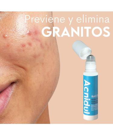ACNIDUL | Immediate action roll-on with glycolic acid and calendula | Eliminate pimples from your face | 14 ml | - Buy Online on GoSupps.com