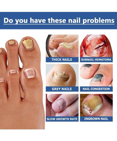 Keratin Nail Growth Oil Nail Strengthener for Damaged Nails - Buy Online on GoSupps.com