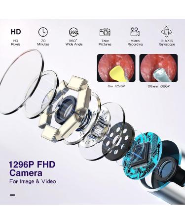 OTAONE Ear Wax Removal Tool with 1296P FHD Camera and Built-in WiFi - Purple - Buy Online on GoSupps.com