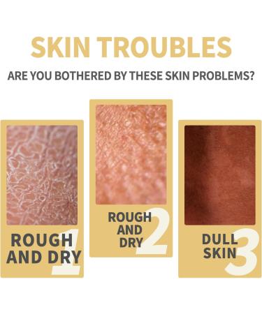 KOAHDE Super Strength Peeling Oil Removing Exfoliating Oil Bright White Exfoliating Oil Remove Exfoliating Moisturizing Oil Natural Spots Whitening Peeling Oil Yellow Peeling Oil All Types 50ML - Buy Online on GoSupps.com