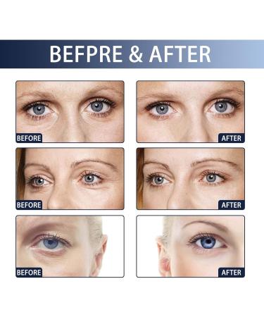  Orgrul Anti Wrinkle Serum Instant Firm Eye Cream with Collagen & Aloe Vera Extract Eye Cream for Dark Circles and Parasite Eyelids Eliminates Wrinkles - Buy Online on GoSupps.com