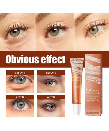 Milia Removal Eye Creams Milia Spots Removal Eye Cream Milia Remover Firming Anti Wrinkle Whitening Eye Cream Smooth Milia Eyes Cream Milia Spot Care Cream 15g - Buy Online on GoSupps.com