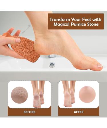 Love Natural Pumice Stone for Feet - 2-Sided Terra Cotta Exfoliating Scrubber for Callus Removal & Dead Skin Care - Buy Online on GoSupps.com
