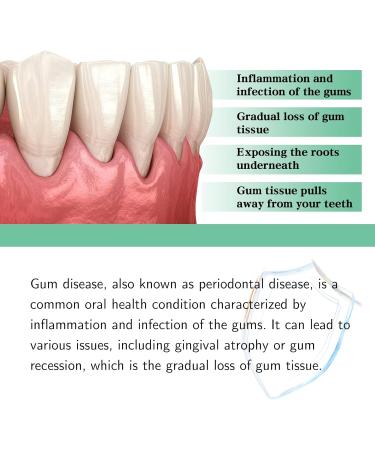 South Moon Gum Repair Drops - Oil Pulling & Gums Treatment for All Ages (2PCs) - Enhance Oral Health & Freshness - Buy Online on GoSupps.com