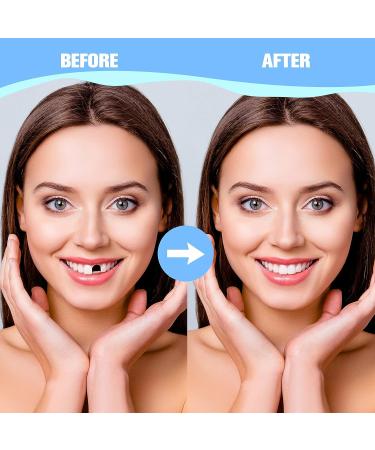 200 Pcs Fake Teeth for Missing Teeth - DIY Temporary Tooth Replacement Kit with Thermal Beads for Holiday Cosplay - Buy Online on GoSupps.com