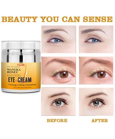 Buy Manuka Honey Eye Cream - Reduce Dark Circles & Puffiness | Anti-Aging Retinol & Aloe Vera Formula for Fine Lines - Buy Online on GoSupps.com