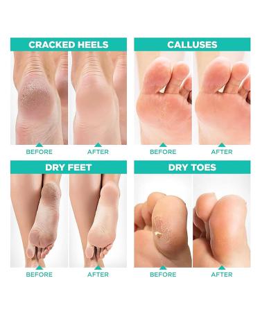 Joyeee Cornea Socks - 3 Pairs Foot Peel Mask for Callus Dead & Dry Skin Removal | Effective Foot Care - Buy Online on GoSupps.com