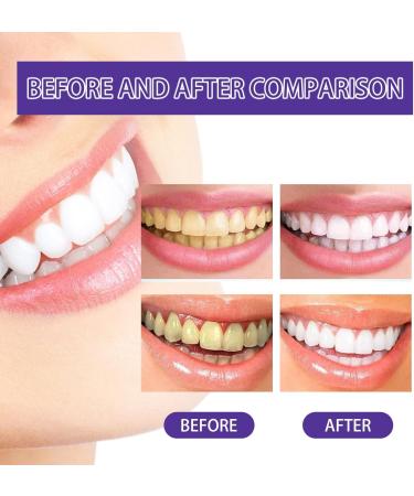 2PC Purple Toothpaste for Whitening | Yellow Teeth Remover | Glowing Smile - Buy Online on GoSupps.com