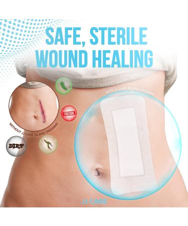 JJ CARE Adhesive Island Dressing Pack of 25 - 4x8 Sterile Bordered Gauze | Non-Stick Latex-Free Wound Dressing | Breathable & Highly Absorbent | 4x8 Inch - Buy Online on GoSupps.com