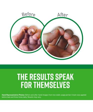 O'Keeffe's Working Hands & Healthy Feet Cream Bundle - 7 oz Tubes for Ultimate Moisture - Buy Online on GoSupps.com