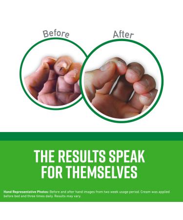 O'Keeffe's Working Hands Hand Cream Tube 3oz (Pack of 3) | Moisturizing Hand Cream Set - Buy Online on GoSupps.com