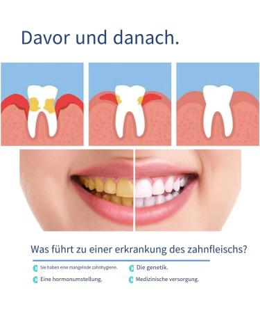 Oral Gel for Gum Treatment - Effective Gum Protection Therapy (2PCs) | Neslemy Gum Gel - Buy Online on GoSupps.com