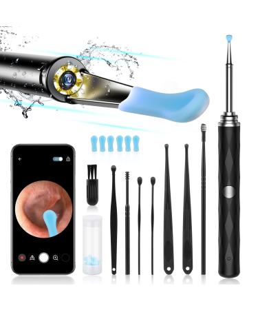 High Definition Ear Wax Removal  Wireless Ear Cleaner  Safe and Gentle Ear Wax Removal Kit  Otoscope with Light  Rechargeable Ear Cleaner with Camera and Light  Ear Cleaning Kit for Android and iOS Black