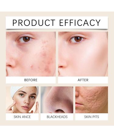 Amino Acid Face Wash Gentle Facial Cleanser for Sensitive Skin: Nourishing and Pore-Tightening Formula for Balanced Skin 3.53 oz White - Buy Online on GoSupps.com