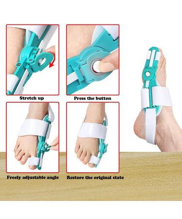 Upgraded Bunion Corrector for Men & Women - Adjustable Splint & Non-Slip Toe Separator for Pain Relief | Orthopedic Bunion Treatment - Buy Online on GoSupps.com