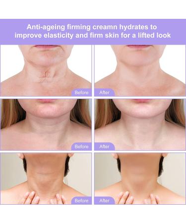 Neck Firming Cream 120ml | Skin Firming Lotion for Neck & Body - Anti-Aging, Wrinkles, Double Chin Reduction, Sagging Skin Tightening - Buy Online on GoSupps.com