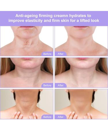 Channel Neck Tightening Cream - Anti-Aging Skin Tightening Lotion for Neck & Body Reduces Double Chin & Firms Sagging Skin (120 ml) - Buy Online on GoSupps.com