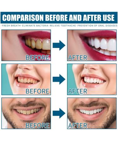 Teethaid Mouthwash 2PCs - Natural Tartar Removal & Tooth Whitening for Healthy Gums | Brightening Mouth Care - Buy Online on GoSupps.com