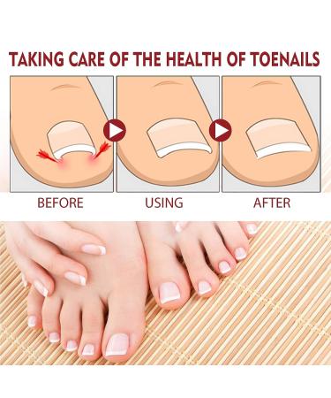 German Toenailplus & NailPro Anti Paronychia Relief Oil Set for Damaged Nails - Buy Online on GoSupps.com