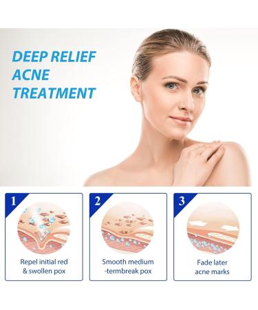 Set of 3 Creams for Manchas Oscuras en La Cara Cremas for Quitar Manchas de La Cara Crema para Manchas en La Cara Crema para Las Manchas de La Cara 20 g - Buy Online on GoSupps.com