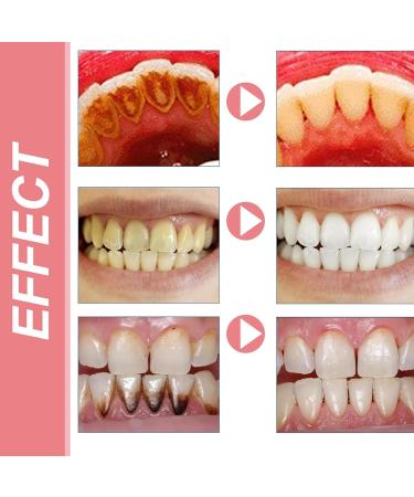 BioDental Harmony Toothpaste BioDental Probiotic Whitening Toothpaste Freshens Breath and Removes Stains - Buy Online on GoSupps.com