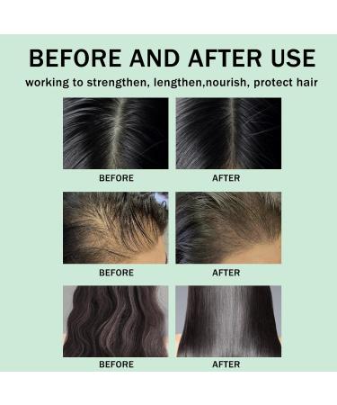 Rosemary Oil for Hair Growth & Skin Care Rosemary Oil for Hair Improve Hair Loss & Promote Hair Growth Strengthen & Nourish Follicles Daily Use Repair Dry Split End Care with Castor Oil Mint Oil - Buy Online on GoSupps.com