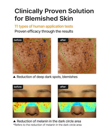 celimax Pore+Dark Spot Brightening Cream | with Niacinamide Tranexamic Acid TXA Cream Pore Minimizer Non-Irritating Hydrating For Sensitive Skin Valentine's Gift 35ml - Buy Online on GoSupps.com