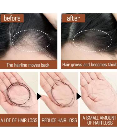 Batana Oil for Healthy Hair Batana Oil for Hair Growth Nourishes Thin Hair Scalp Skin and Loss Hair Growth Natural Batana Oil Promotes Hair Wellness for Men & Women Hair Care Hair Treatment(50ml) - Buy Online on GoSupps.com