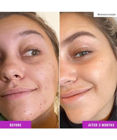 Good Molecules Niacinamide Brightening Toner - Buy Online on GoSupps.com