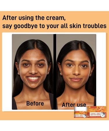Kojic Acid Skin Lightening Cream - Moisturiser Face Women - Kojic Acid Cream with Turmeric - Anti Aging Face Cream for Anti-wrinkle - Brighten & Even Skin Tone Moisturizing Dark Spots Firming Skin - Buy Online on GoSupps.com