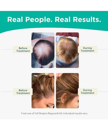 Shapiro MD Hair Loss Shampoo & Leave-in Conditioner | DHT Fighting Vegan Formula | Developed by Dermatologists | 1-Month Supply - Buy Online on GoSupps.com
