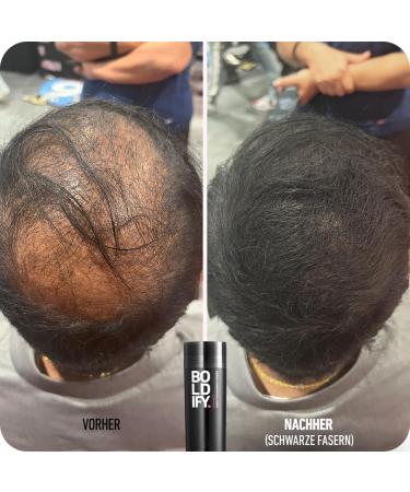 Boldify Hair Powder for Thinning Hair - Invisible & Natural - 28g Black - Conceal Hair Loss in 15 Sec - Perfect for Men & Women - Buy Online on GoSupps.com