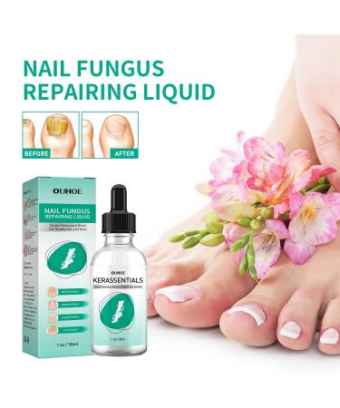 Kerassentials Toenail Treatment Oil - Repair Damaged and Discolored Nails - Buy Online on GoSupps.com