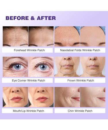 Forehead Wrinkle Patches Face Wrinkle Patches for Face Overnight Face Wrinkle Patches for Forehead Wrinkles Treatment Face Smoothing Patches Anti Wrinkle Patches Wrinkle Remover Strips/840 - Buy Online on GoSupps.com