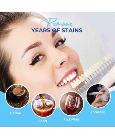 LUELLI Teeth Whitening Strips - 7-Day Whitening Kit - 10 Shades Whiter - 14 Treatments - Buy Online on GoSupps.com