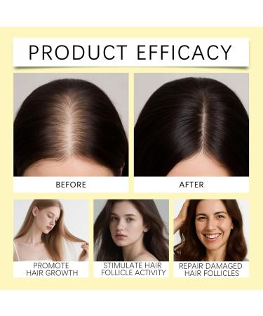 Battana Hair Care 100ml. Natural Battana promotes hair growth improves dryness and roughness and moisturizes the scalp and hair. Suitable for all hair types. - Buy Online on GoSupps.com