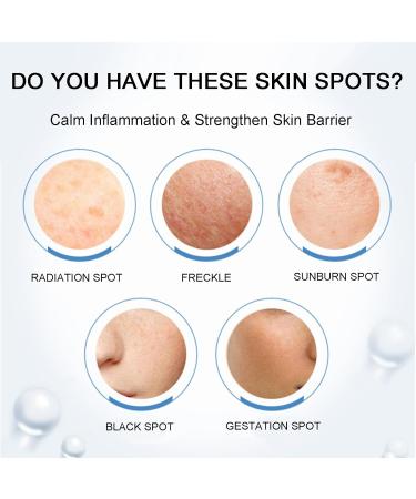Freckle Removal Cream Dark Spot Remover for Face with Sodium Hyaluronate & Nicotinamide Spot Cream Sun Spots and Melasma Freckle Remover Dark Spot Corrector Cream Brighten Skin Tone - Buy Online on GoSupps.com