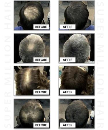 Super Million Hair 1 x 25g Hair Building Fibers No. 6 Light Blonde - Buy Online on GoSupps.com