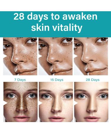 paminify Dark Spot Remover For Face & Body Nicotinamide Freckle Remover Cream Anti-Aging Dark Spot Corrector for Age Spot Sun Spot Moisturizing & Gentle on Skin 1 oz - Buy Online on GoSupps.com